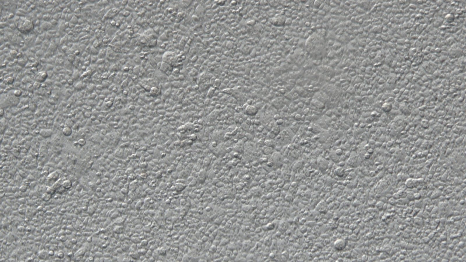 1-first-calec-patients-stem-cells-in-culture-credit-mass-eye-and-ear 1. First Calec Patient's Stem Cells In Culture. Credit Mass Eye And Ear