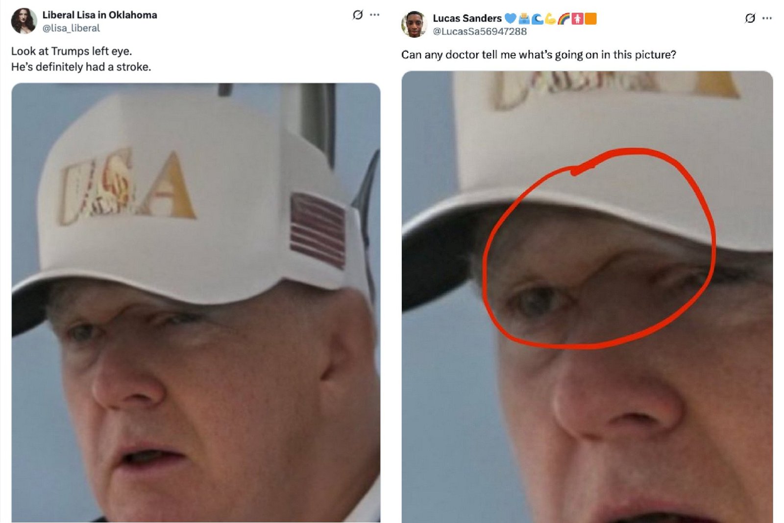 trump-both-wrong Two tweets speculating about the mass on Trump's head, which was added by AI enhancement tools.